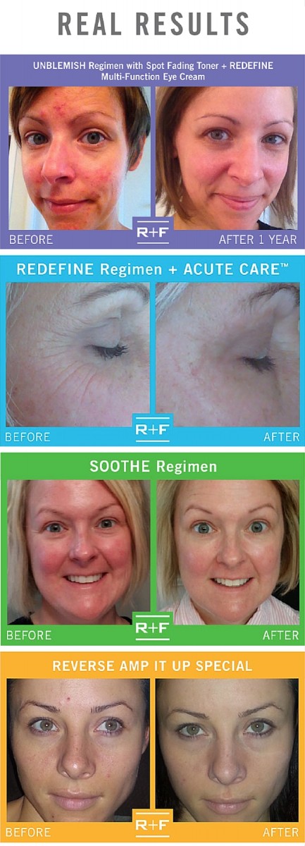 Rodan + Fields Skincare - Before + Afters, Giveaways + More!